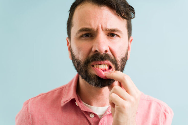 A man in a pink shirt pulls down his lower lip to expose his gums, looking concerned, likely inspecting for a dental or gum issue. Background is a soft blue. A man in a pink shirt pulls down his lower lip to expose his gums, looking concerned, likely inspecting for a dental or gum issue. Background is a soft blue