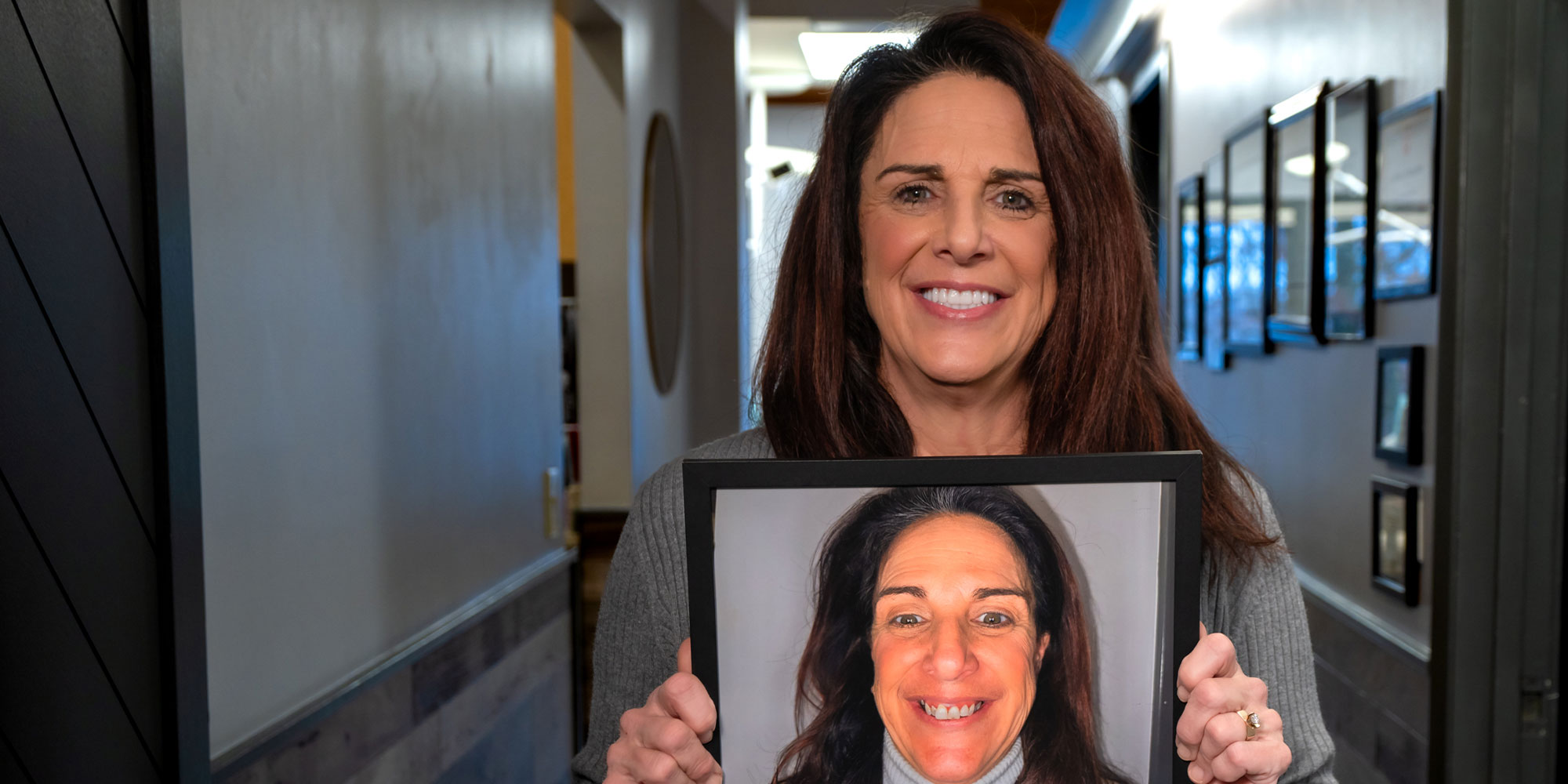 Patient holding up a before and after Picture of their teeth
